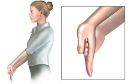 Golfer Elbow Stretch